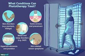 Phototherapy Uses Benefits And Risks
