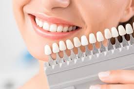 The 8 best teeth whitening products of 2021. Why Do We Experience Sensitive Teeth After Whitening Sensodyne