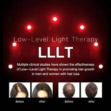 This condition causes the hair follicles to go into their resting. Buy Lescolton Hair Growth System Fda Cleared Hair Loss Treatment Device For Thinning Hair Restore Hair Thickness Volume And Density Online In Vietnam B08b4n6sz6