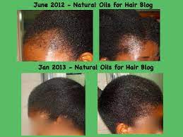 If you aren't sure how to use jamaican black castor oil for hair growth, just follow these steps: How To Regrow Bald Spots With Jamaican Black Castor Oil Castor Oil For Hair Hair Growth Oil Jamaican Black Castor Oil