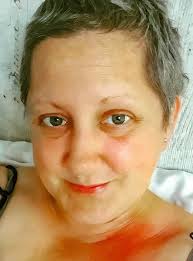 Sarah Harding messaged me when I found out my breast cancer was terminal