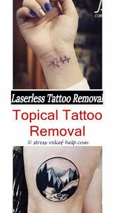 Click here for more info! Removable Tattoo Ink How Much To Get A Tattoo Removed Uk How To Remove Henna Tattoo From Tattoo Removal Cost Eyebrow Tattoo Removal Tattoo Removal