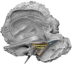 Meniere's disease is progressive, and there is not a known cure, and all treatment options are symptomatic. Surgical Anatomy Of The Temporal Bone Intechopen