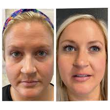 Meet LeKeya Weir, MSN, RN