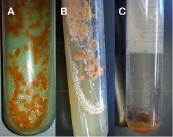 Lowenstein jensen medium (lj medium) is a selective medium that is commonly used for the cultivation and isolation of mycobacterium (notably mycobacterium. Macroscopic Growth Of Nocardia Sp In A Lowenstein Jensen Medium B Download Scientific Diagram