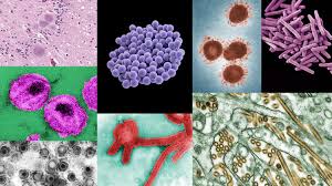Which Contagious Diseases Are The Deadliest Goats And Soda Npr