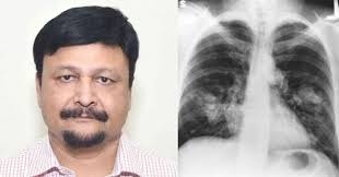 IIT Professor Says With His Software COVID-19 Can Be Detected In 5 Seconds