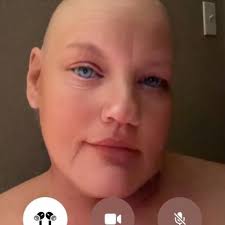 CHERYL ANN BREWER, MD