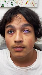 Gotta copy the Yam destruction techniques 🧑🏽‍🦯 #naruto #sharingan #...