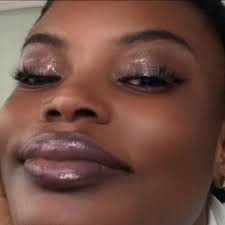 The surgery for the separation of the Siamese twins who are joined at the  head has started at the Greater Accra Regional Hospital today, Monday  December 6. The marathon surgery being handled