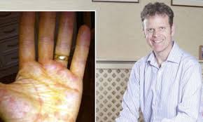 We did not find results for: Rashes When An Itch Wrecks Your Life And Nothing Can Get Rid Of It Daily Mail Online
