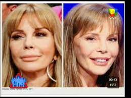 Maybe you would like to learn more about one of these? Graciela Alfano Antes Y Despues Cirugias Neofama Com Youtube