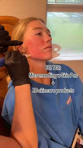 Christine Bateman, MSN, FNP-BC (@injector_tine) • Instagram photos and  videos