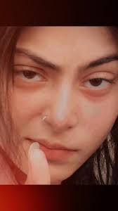 How to Unfreeze Your Account