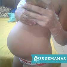 Barriga Muito Baixa Com 35 Semanas Fevereiro De 2017 Babycenter
