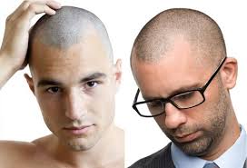 The standard cut, also known as a regular cut, taper cut, or professional cut, has a (sometimes undefined) side part. 10 Different Types Of Buzz Cut Hairstylecamp