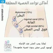 ترقية وظيفية ينبهر افرغ القمامة الخصيه المعلقه عند الرجال comertinsaat com