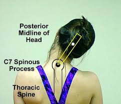 Cervical Spine Sidebending Manual Muscle Testing Muscle Testing Physical Therapist Assistant