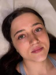 Still looking for people to model beauty treatments this week only slots  this a discounted treatments Slots are going fast if you are interested  please comment below or drop me a message