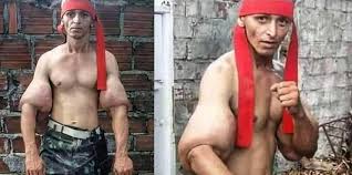 Rambo Synthol Freak Pictures Go Viral Fitness Volt More than 171 muscle explosion at pleasant prices up to 17 usd fast and free worldwide shipping! rambo synthol freak pictures go viral