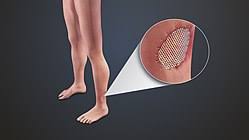 نتیجه جستجوی لغت [graft] در گوگل