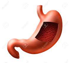 We did not find results for: An Illustration Of Human Stomach With Inside View Stock Photo Picture And Royalty Free Image Image 17306135