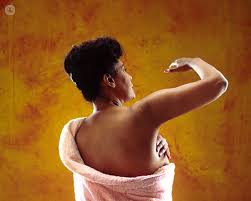 Breast cancer often presents itself when a woman notices something out of the ordinary in her breast, a lump that feels different from the feeling of surrounding tissues and structures or a change, something new and different that was not felt before. Savi Scout A Breast Cancer Surgery Advancement Top Doctors