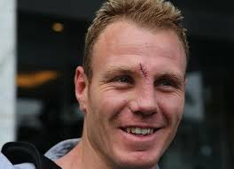 Hopoate out of decider as Blues' injuries mount