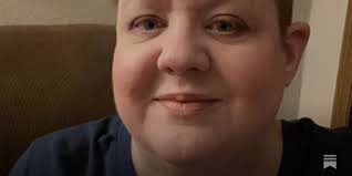 Living With Congenital Heart Disease: Diagnosis in Adulthood