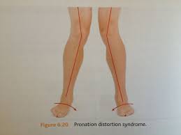 Pin On Pain In Shins