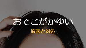 おでこがかゆい原因と対処 対処 治療 アトピー