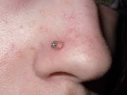Nose Piercing Bump 6 Causes And How To Treat Them Authoritytattoo