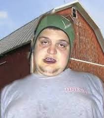 Man Hacks Off His Own Arm