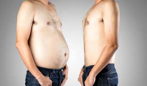 Redessiner la culotte de cheval. La Liposuccion Du Ventre Pour Homme Est Elle Efficace Elle Esthetique