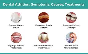 Image result for Tooth Attrition