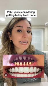 Carla Alban's Instagram, Twitter & Facebook