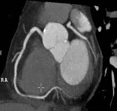 Am untersuchungstisch liegend wird ihnen während der. Kardiologie Rontgen Thorax Thorax Ct Kardio Ct Kardio Mr