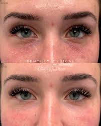 Bentley Medical & Aesthetics