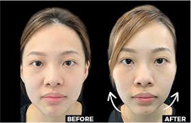 ONLY Home l Aesthetic Treatments In The Comfort Of Your Own Home!