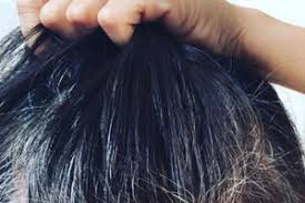 haare farben forum schwangerschaft urbia de