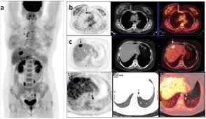 A radiographer operates the scanner. Clinical Impact Of 18f Fdg Pet Ct On Initial Staging And Therapy Planning For Breast Cancer