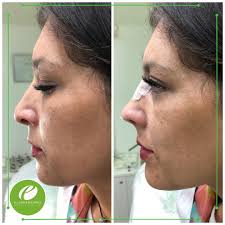 Dra. Erica Polonsky Medicina Estetica Laser