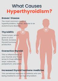 Thyroid cancer is not considered the most common form; Hyperthyroidism Symptoms Causes Diagnosis And Treatments Causes Symptoms Diagnosis Treatments And Support