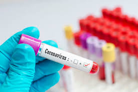 A hard lockdown will remain a possibility. Gauteng Looking At Intermittent Lockdown As It Prepares For Worst In Covid 19 Cases