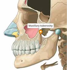 Image result for Maxillary Bone