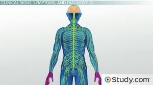 The estimated annual incidence in the united. Guillain Barre Syndrome Sudden Paralysis Video Lesson Transcript Study Com