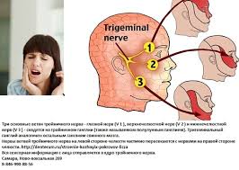 как лечить воспаление тройничного лицевого нерва в домашних условиях Simptomy Nevralgii Perifericheskoj I Lechenie