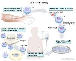 An antigen is a substance that stimulates your body's immune system. Definition Of Car T Cell Therapy Nci Dictionary Of Cancer Terms National Cancer Institute