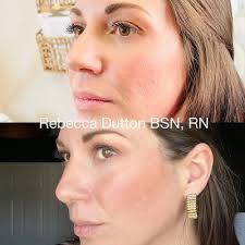 Illume Aesthetics, 5344 Highway N, Saint Charles, MO 63304, US