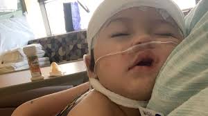 COVID and children: Doctors worry about disparities in kids of color